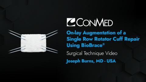 Dr. Burns - On-lay Augmentation of a Single Row Rotator Cuff Repair using BioBrace®
