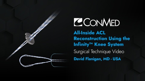 Dr. Flanigan - All-Inside ACL Reconstruction Using the Infinity™ Knee System