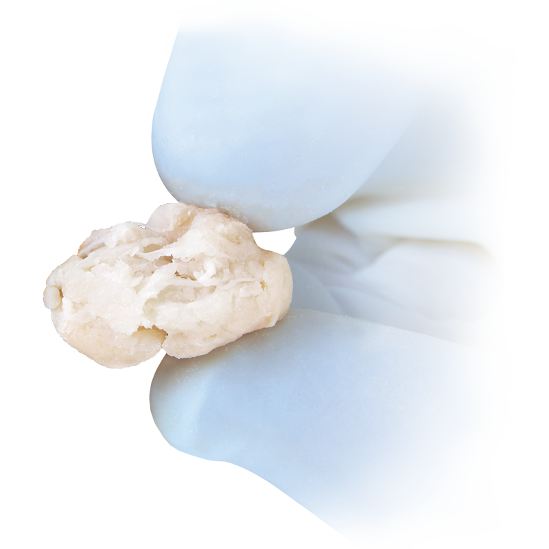 two fingers wearing blue latex gloves holding cartimax viable cartilage allograft showing its features